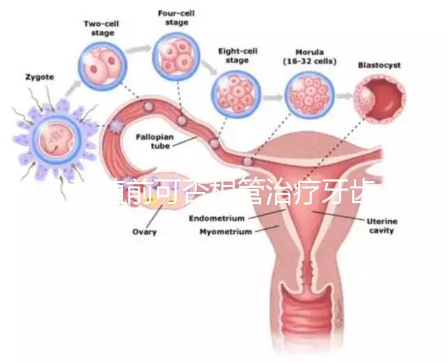 移植前可否根管治療牙齒看情況,這些影響別還不知道