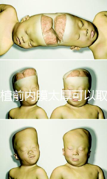 移植前內膜太厚可以取卵早知道,疼痛因人而異