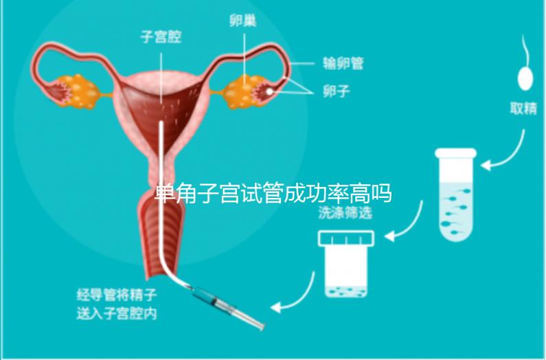 單角子宮試管成功率高嗎？送你5招降低胚胎著床的難度