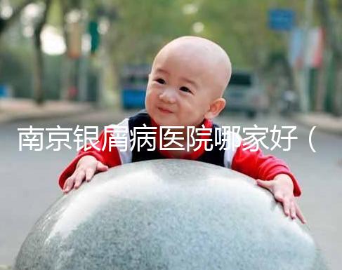 南京銀屑病醫院哪家好（南京專門看銀屑病醫院）
