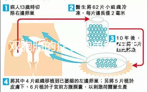 雙胞胎的癥狀和單胎有太多不一樣，被蒙在鼓里還不知道