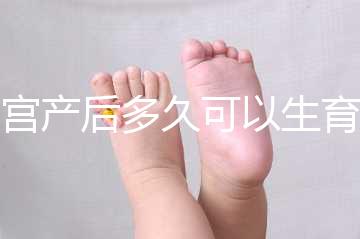 剖宮產(chǎn)后多久可以生育二胎？