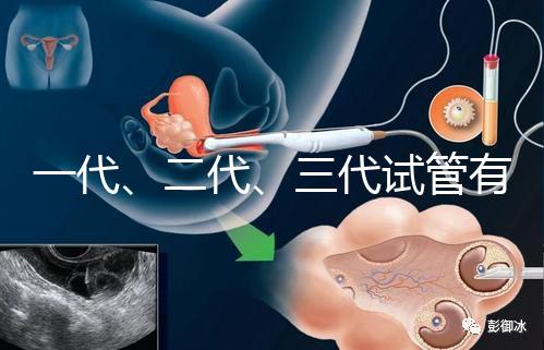 一代、二代、三代試管有什么區別?