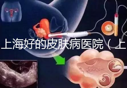 上海好的皮膚病醫院（上海皮膚科排名第一）