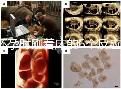 懷孕時(shí)剛著床的6個反應(yīng)，同房后這個時(shí)候觀察身體最準(zhǔn)