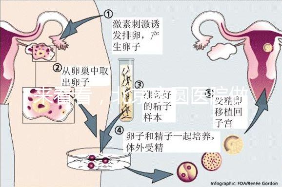 來看看，北京家圓醫院做三代試管費用總共多少？