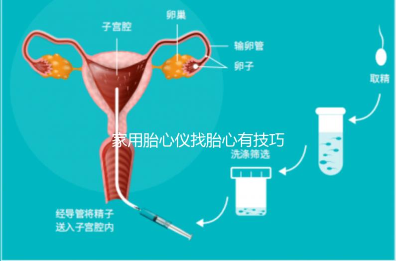家用胎心儀找胎心有技巧，飯后半個小時測準確率稍高