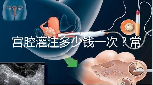 宮腔灌注多少錢一次?常見疑問(wèn)匯總答疑
