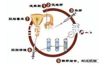 寶寶到媽媽身上就要吃解決方法來了，奶瓶作用大別忽略