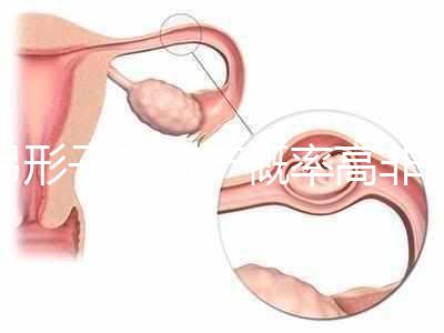 弓形子宮流產(chǎn)概率高非個例！罪魁禍?zhǔn)资沁@個原因