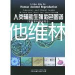 試管用屈他維林片的功效總結,看完能否抑制宮縮就知道了