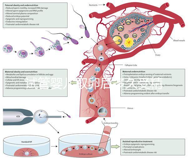 試管嬰兒取卵后多久受精（取卵第二天被告知精卵不結(jié)合）