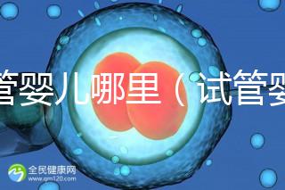 試管嬰兒哪里（試管嬰兒哪里做的最好的醫(yī)院）