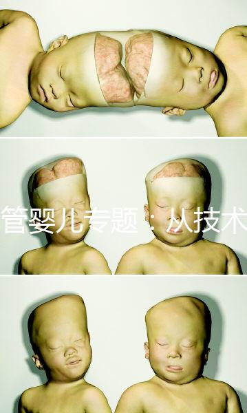 試管嬰兒專題：從技術原理解讀到成功案例分享