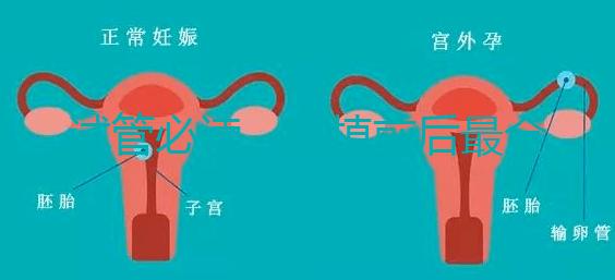 試管必讀，移植前后最全注意事項？