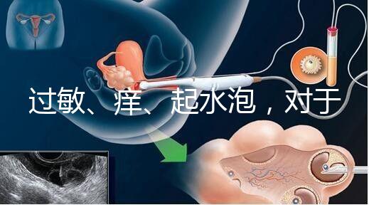 過敏、癢、起水泡，對于三伏貼的副作用你需知道該怎么辦