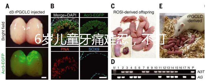 6歲兒童牙痛難忍，不打針吃藥5個(gè)小妙招快速止疼
